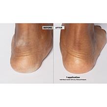 SKINN Non-Negotiables Dermappeal Foot Scrub Auto-Ship®