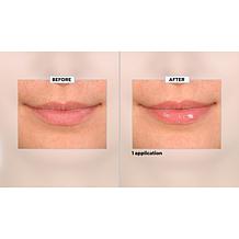 SKINN Non-Negotiables Lip 6x Lip Amplifying Serum Auto-Ship®