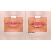 SKINN Non-Negotiables Lip 6x Lip Amplifying Serum