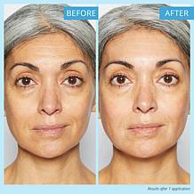 SKINN Non-negotiables Triple-sized DermAppeal 6 fl. oz.