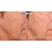 SKINN Supersize DWP Protocol Creme Reverse Intensive Auto-Ship®