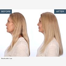 SKINN TrichoLab Volumizing Shampoo & Nourishing Conditioner