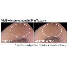 StriVectin Advanced Retinol Nightly Multi-Correct Serum 1 oz.