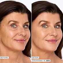 tarte shape tape™ Radiant Medium Coverage Concealer - Light-Med Honey