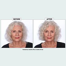 The Beauty Spy Dr. Tree PDRN Treatment