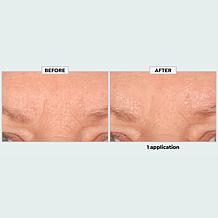 The Beauty Spy Dr. Tree Super Collagen PDRN Wrinkle Patches