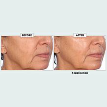 The Beauty Spy Dr. Tree Super Collagen PDRN Wrinkle Patches