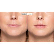 Too Faced 2-piece Lip Injection Set