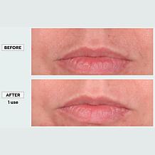 TruRitual Dermaplaning Kit with Replacement Blades