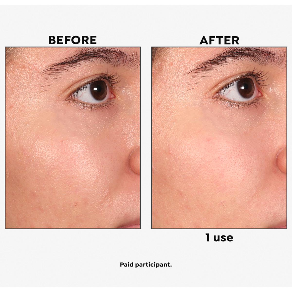 [値下げ]BEAUTYBIO BeautyBio GLOfacial Tool Set with 6 oz. Balance Cleanser | HSN