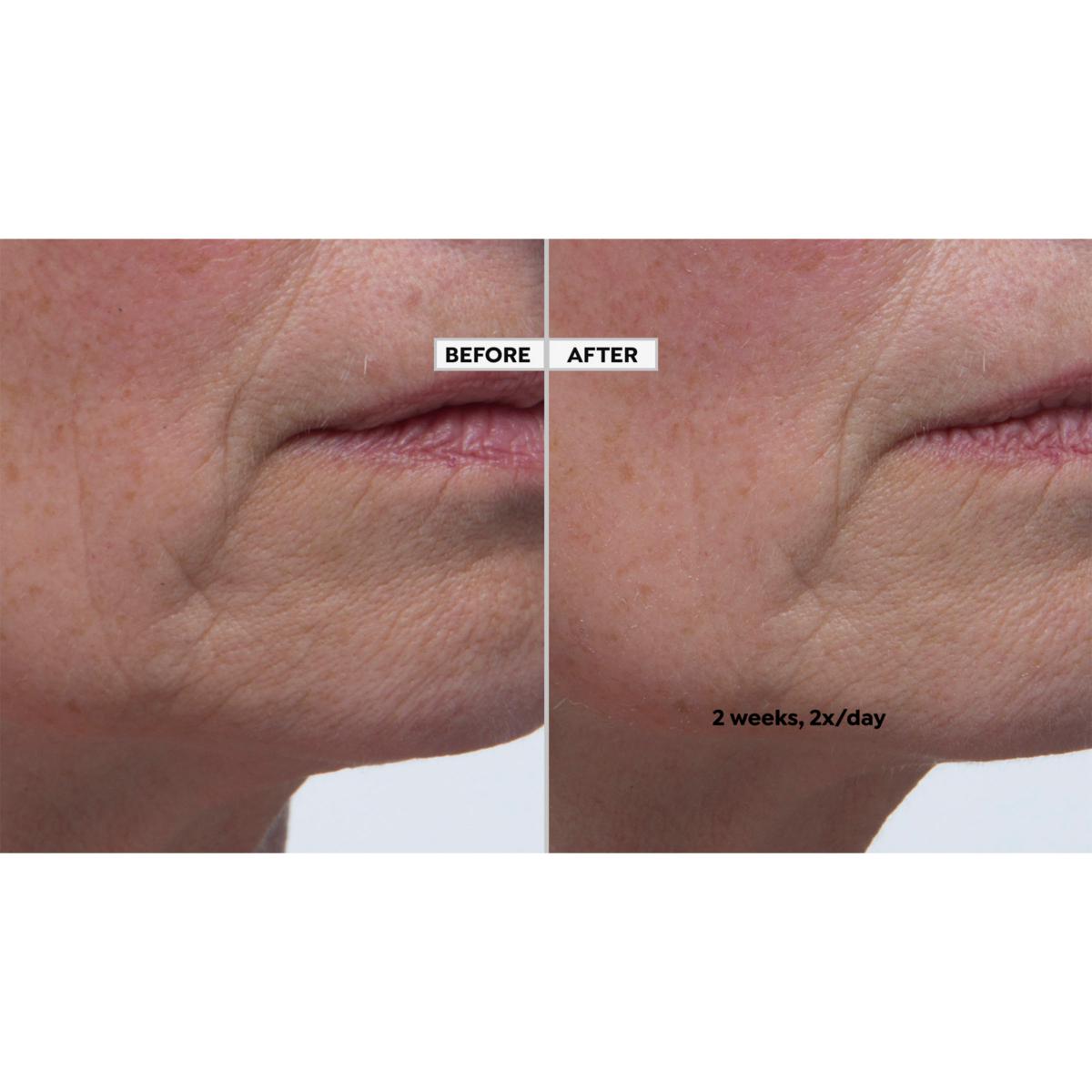 BeautyBio Plumping Booster Serum & ZenBubble Gel Cream