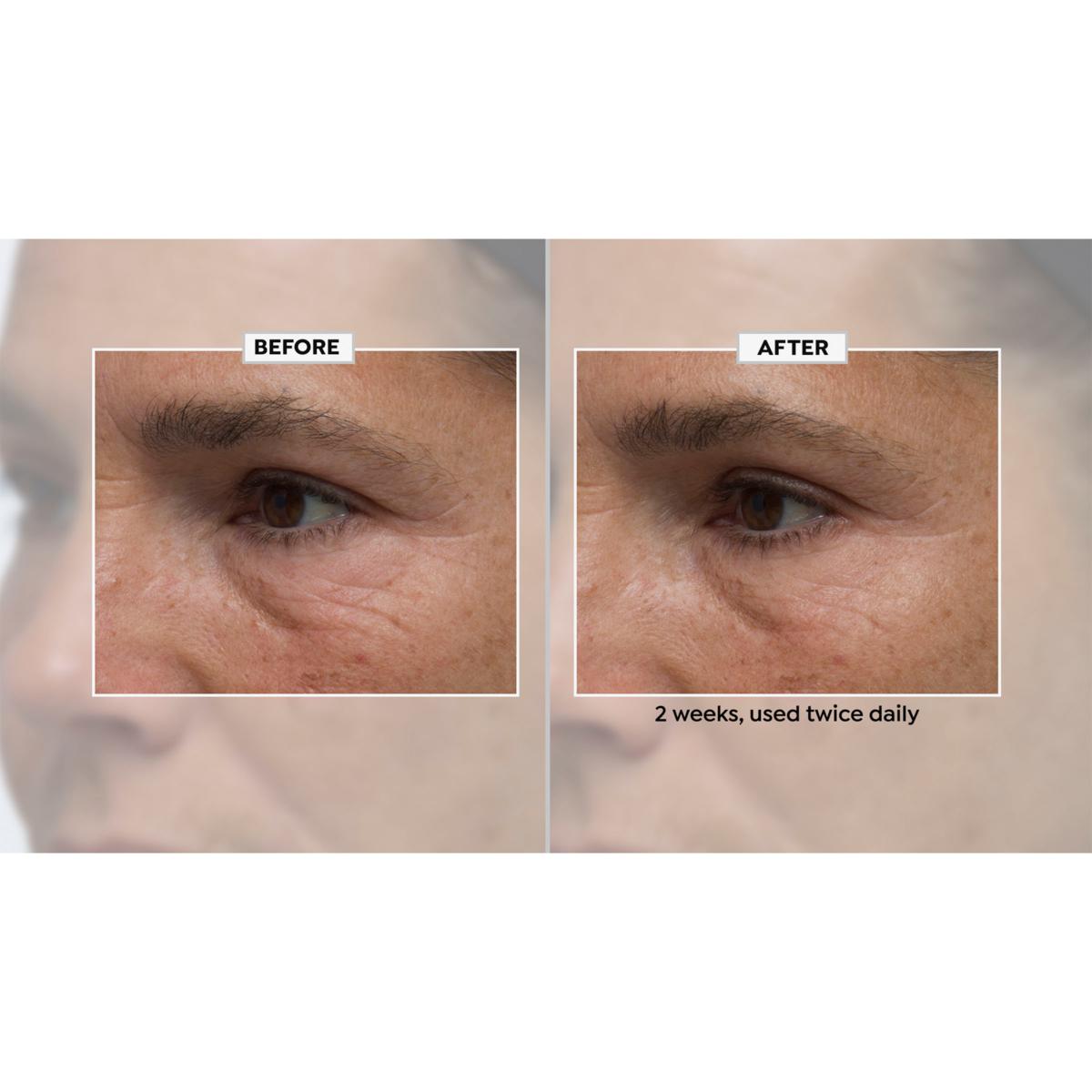 BeautyBio Plumping Booster Serum & ZenBubble Gel Cream
