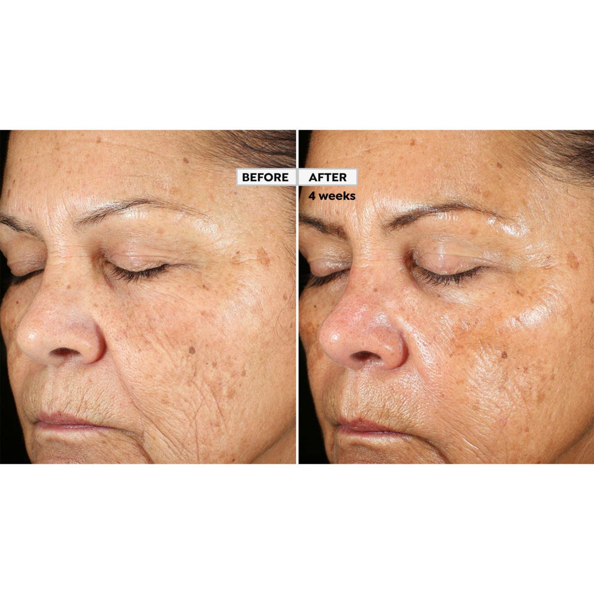 Beekman 1802 Dream Booster Skin Care Serum 3-Pack | HSN