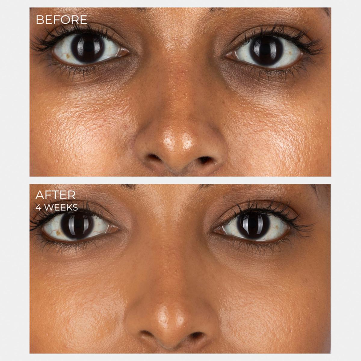 CurrentBody Skin LED Light Therapy Mask | HSN