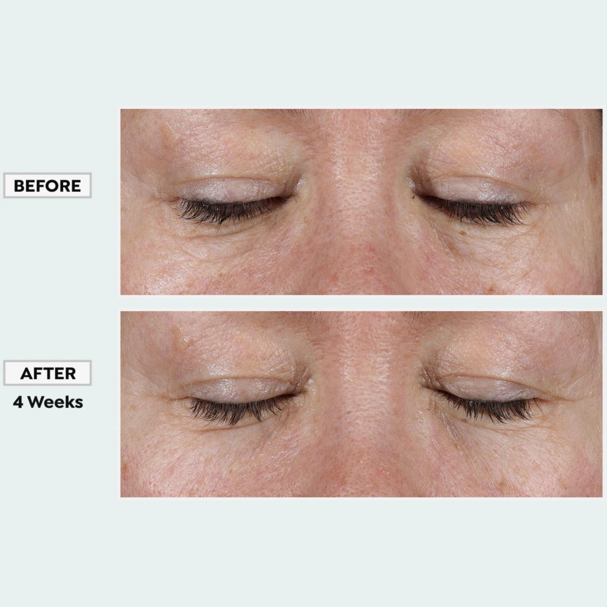 Isomers Skincare Glutathione Correcting Cream