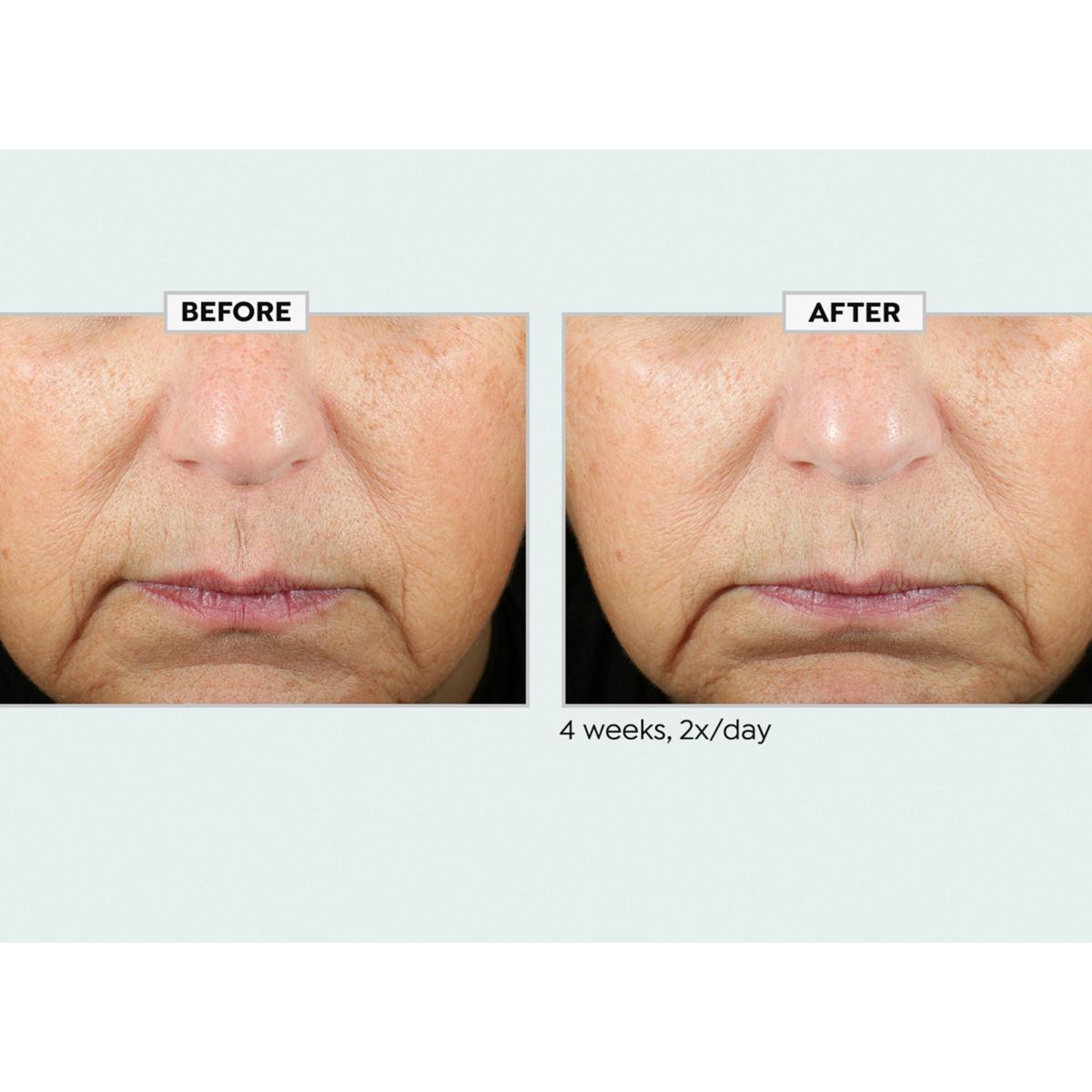 Kate Somerville KateCeuticals SuperCell Serum | HSN