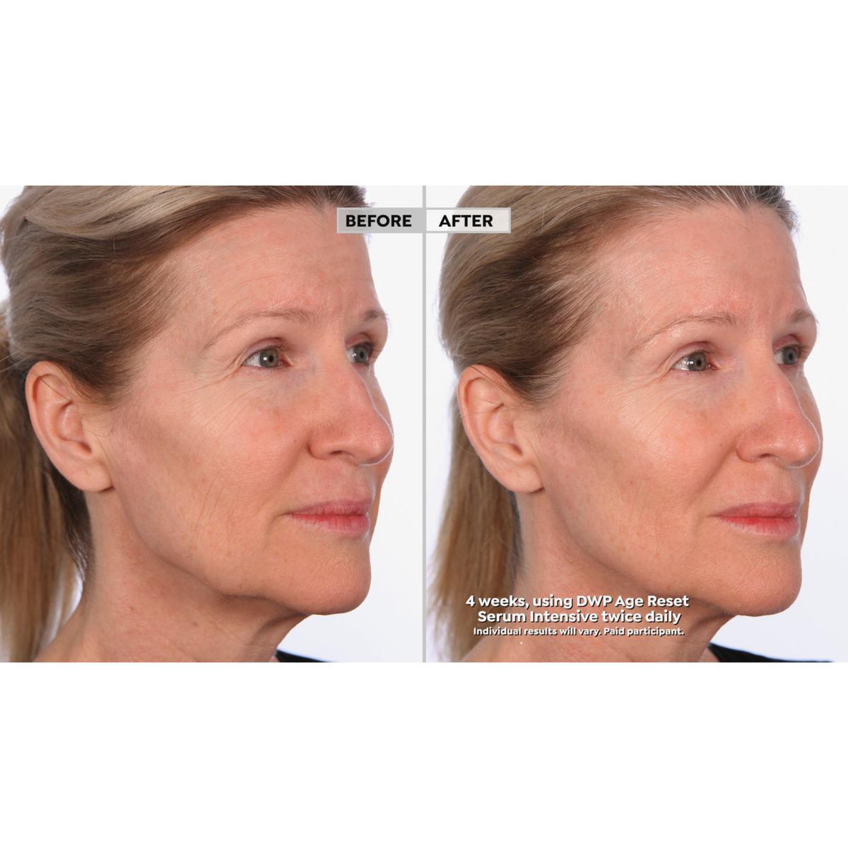 SKINN Age Reset Serum | HSN