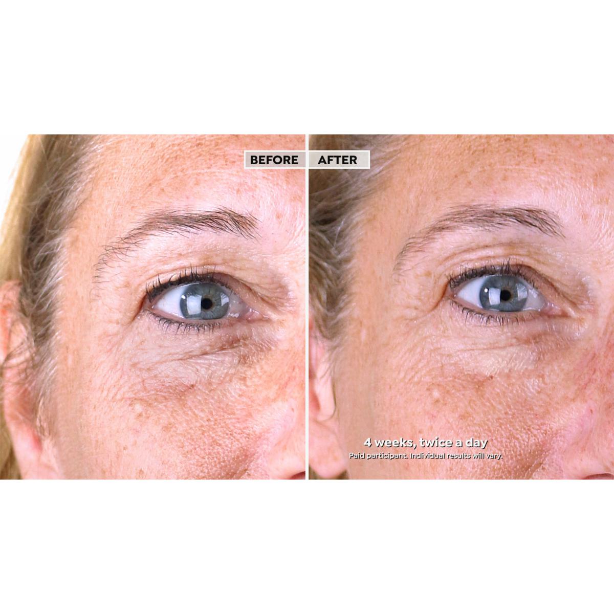 msg HIGHCERA EYE CREAM×2 S__52158472.jpg?crop=center&